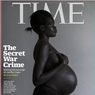 南スーダンの女性の悲惨な現実・・・そしてTIME誌の表紙が話題に！