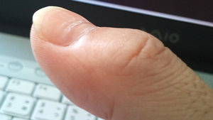 病気 栄養不足の警告 爪で分かるあなたの健康状態 管理方法 おにぎりまとめ